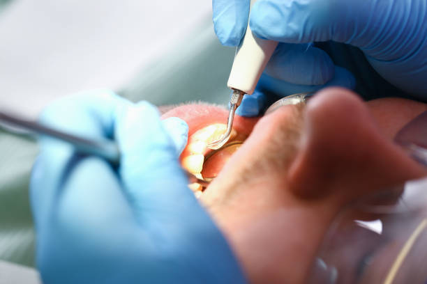 Best Weekend Emergency Dentist in Lochearn, MD